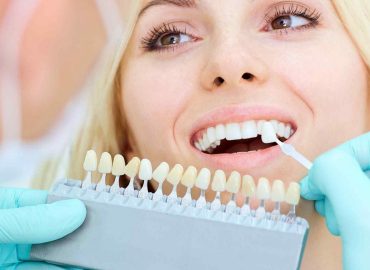 Common Problems Treated by a Veneer Treatment